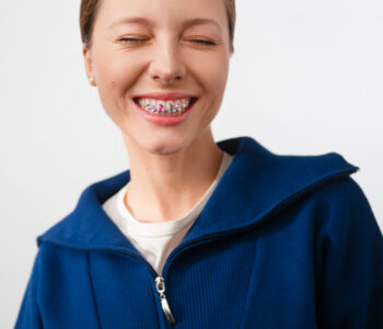 Ile trwa leczenie aparatem samoligaturującym?