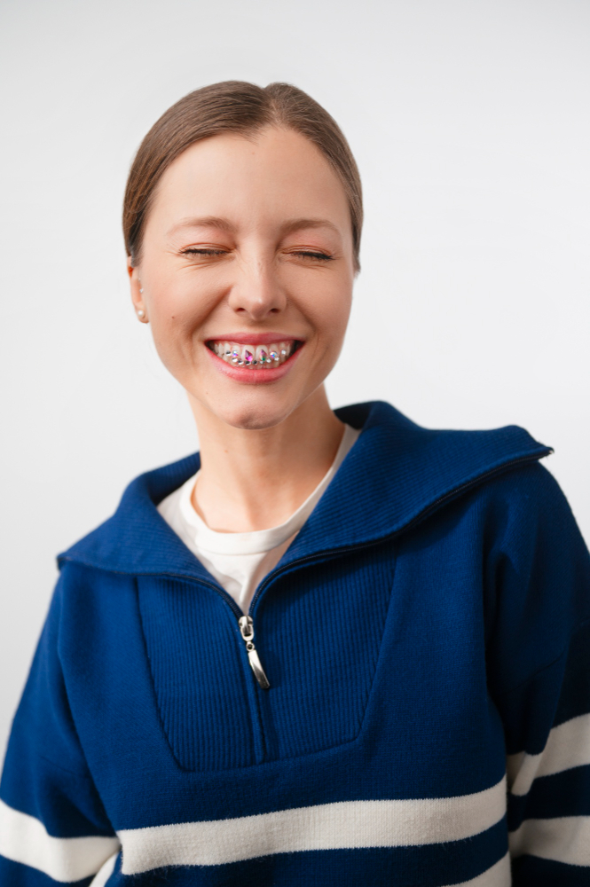 Ile trwa leczenie aparatem samoligaturującym?