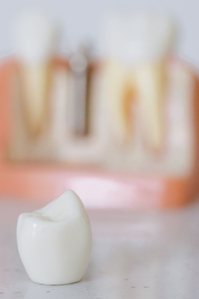 Ile goi się implant zęba po wszczepieniu?