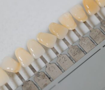 Czym charakteryzuje się licówka porcelanowa?
