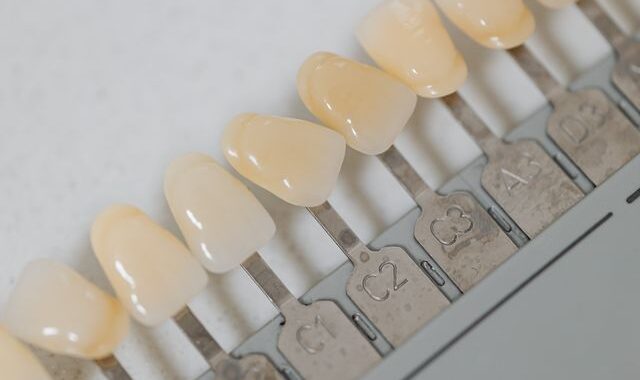 Czym charakteryzuje się licówka porcelanowa?