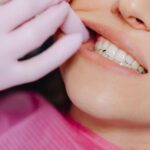 Czy trzeba czekać na zagojenie dziąsła przed wszczepieniem implantu?